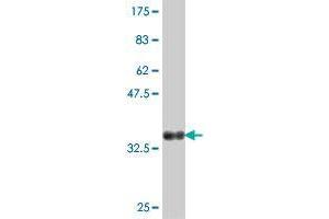 Western Blot detection against Immunogen (37. (PTGES2 antibody  (AA 270-377))