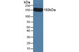 Figure. (SEMA5B antibody  (AA 836-1013))
