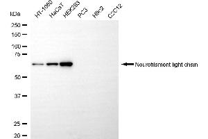 Western blotting analysis using neurofilament light chain antibody (ABIN7799582). (NEFL antibody)
