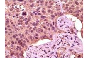 Immunohistochemistry (IHC) image for anti-Glycogen Synthase Kinase 3 alpha (GSK3a) (truncated) antibody (ABIN2464059) (GSK3 alpha antibody  (truncated))
