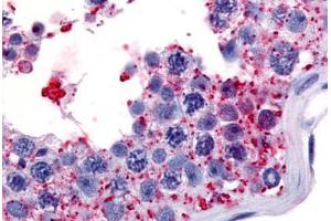 Human Testis (formalin-fixed, paraffin-embedded) stained with WNK1 antibody ABIN213556 at 7 ug/ml followed by biotinylated goat anti-rabbit IgG secondary antibody ABIN481713, alkaline phosphatase-streptavidin and chromogen. (WNK1 antibody  (Internal Region))