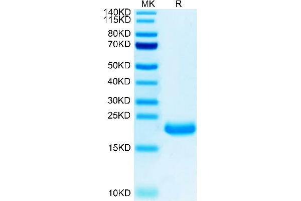 MOG Protein (AA 30-154) (His tag)