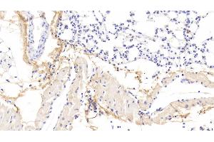Detection of OGN in Mouse Lung Tissue using Polyclonal Antibody to Osteoglycin (OGN) (OGN antibody  (AA 180-298))