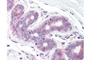 Anti-SLC39A6 antibody IHC of human breast.
