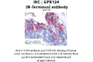 Image no. 1 for anti-G Protein-Coupled Receptor 124 (GPR124) (Extracellular Domain), (N-Term) antibody (ABIN1734920) (GPR124 antibody  (Extracellular Domain, N-Term))