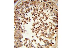 Formalin-fixed and paraffin-embedded human testis tissue reacted with DMC1 antibody (N-term) followed followed by peroxidase-conjugated secondary antibody and DAB staining. (DMC1 antibody  (N-Term))