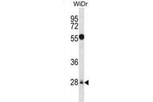 Western Blotting (WB) image for anti-Mediator Complex Subunit 6 (MED6) antibody (ABIN2998132) (MED6 antibody)