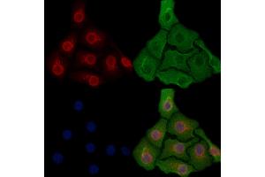ABIN6256891 and ABIN6274295 staining Hela cells by IF/ICC. (ADK antibody  (N-Term))
