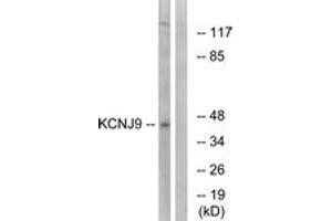 Western Blotting (WB) image for anti-Potassium Inwardly-Rectifying Channel, Subfamily J, Member 9 (KCNJ9) (AA 61-110) antibody (ABIN1534917)
