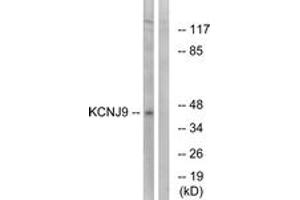 Western blot analysis of extracts from LOVO cells, using KCNJ9 Antibody. (KCNJ9 antibody  (AA 61-110))
