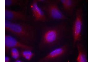 Immunofluorescence staining of methanol-fixed Hela cells using TrkA(Phospho-Ser791) Antibody. (TRKA antibody  (pTyr791))