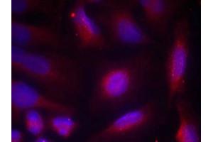 Immunofluorescence staining of methanol-fixed Hela cells using TrkA(Phospho-Ser791) Antibody. (TRKA antibody  (pTyr791))