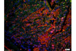 Formalin-fixed and paraffin embedded mouse small intestine labeled with Anti TSPAN20/UPIb Polyclonal Antibody, PE conjugated -PE) 1:200, 60 minutes at 37°C. (Uroplakin 1B antibody  (AA 150-197))