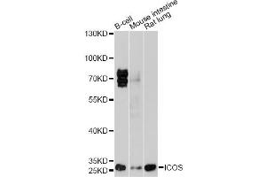 Western blot analysis of extracts of various cell lines, using ICOS antibody (ABIN1873127) at 1:1000 dilution. (ICOS antibody)