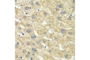 Immunohistochemistry of paraffin-embedded human liver injury using DLD antibody.