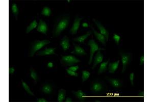 Immunofluorescence of monoclonal antibody to TCF19 on HeLa cell. (TCF19 antibody  (AA 17-102))