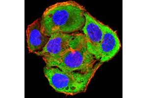 anti-ROP1 (AA 42-183) antibody