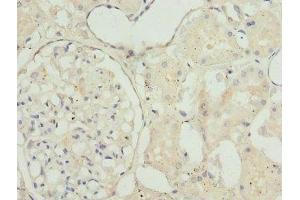 Immunohistochemistry of paraffin-embedded human kidney tissue using ABIN7172851 at dilution of 1:100 (TAGLN2 antibody  (AA 1-199))