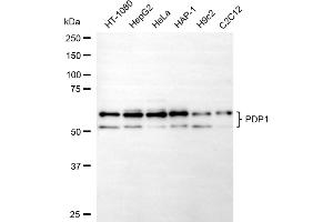 anti-Pyruvate Dehydrogenase Phosphatase (PDP) antibody
