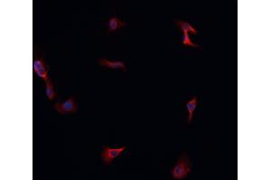 ABIN6266814 staining A549 cells by IF/ICC.