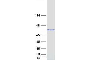 Validation with Western Blot (RBCK1 Protein (Transcript Variant 2) (Myc-DYKDDDDK Tag))