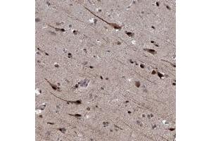 Immunohistochemical staining of human cerebral cortex with PHF8 polyclonal antibody  shows strong nuclear and cytoplasmic positivity in neuronal cells.