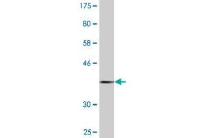 Western Blot detection against Immunogen (37. (Prolactin Receptor antibody  (AA 371-479))