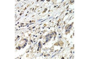 Immunohistochemistry (IHC) image for anti-Budding Uninhibited By Benzimidazoles 1 Homolog beta (Yeast) (BUB1B) (AA 1-260) antibody (ABIN6218879) (BUB1B antibody  (AA 1-260))