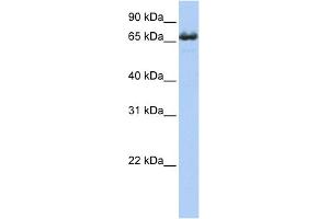 WB Suggested Anti-ZDHHC17 Antibody Titration:  0. (ZDHHC17 antibody  (Middle Region))