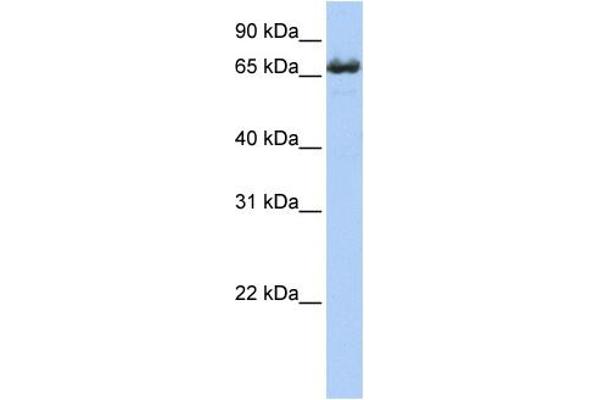 ZDHHC17 Antikörper  (Middle Region)