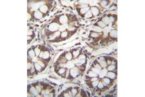 Immunohistochemistry analysis in human rectum tissue (formalin-fixed, paraffin-embedded) using Ladinin-1  Antibody (N-term), followed by peroxidase conjugation of the secondary antibody and DAB staining. (Ladinin 1 antibody  (N-Term))