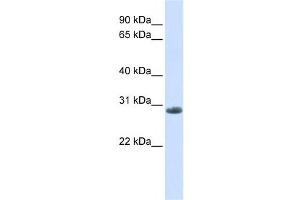 Western Blotting (WB) image for anti-Yip1 Domain Family, Member 6 (YIPF6) antibody (ABIN2458683)