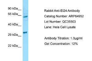 Western Blotting (WB) image for anti-Etoposide Induced 2.4 (EI24) (N-Term) antibody (ABIN970601) (EI24 antibody  (N-Term))