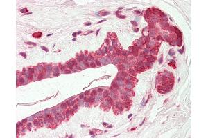 Human Breast: Formalin-Fixed, Paraffin-Embedded (FFPE) (AMIGO2 antibody  (C-Term))