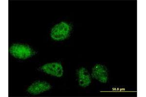 Immunofluorescence of purified MaxPab antibody to SERTAD2 on HeLa cell. (SERTAD2 antibody  (AA 1-314))