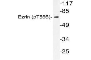 Western blot (WB) analyzes of p-Ezrin (pThr566) antibody in extracts from Jurkat PMA cells. (Ezrin antibody  (pThr566))