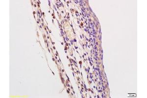 Formalin-fixed and paraffin embedded mouse embryo labeled with Rabbit Anti TLR9/CD289 Polyclonal Antibody, Unconjugated (ABIN749588) at 1:200 followed by conjugation to the secondary antibody and DAB staining (TLR9 antibody  (AA 951-1032))