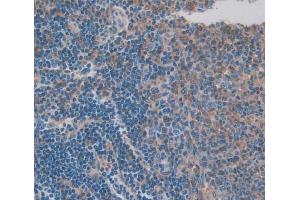 Used in DAB staining on fromalin fixed paraffin- embedded spleen tissue (CFP antibody  (AA 65-190))