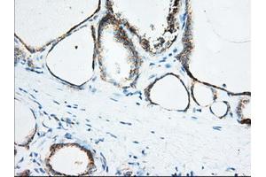 Immunohistochemical staining of paraffin-embedded Human Kidney tissue using anti-KHK mouse monoclonal antibody.