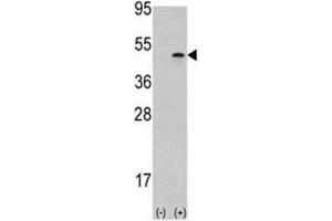 Western blot analysis of Aurora B antibody and 293 cell lysate (2 ug/lane) either nontransfected (Lane 1) or transiently transfected with the AURKB gene (2). (Aurora Kinase B antibody  (AA 283-313))