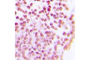 Immunohistochemistry (IHC) image for anti-Sirtuin 1 (SIRT1) antibody (ABIN7308334)
