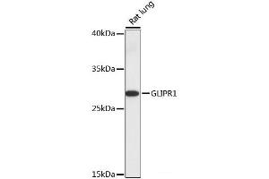 Western blot analysis of extracts of Rat lung using GLIPR1 Polyclonal Antibody at dilution of 1:1000. (GLIPR1 antibody)