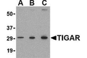 Western blot analysis of TIGAR in MCF7 cell lysate with this product at (A) 0. (TIGAR antibody  (Center))