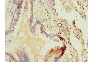 Immunohistochemistry (IHC) image for anti-Zinc Finger, DHHC-Type Containing 5 (ZDHHC5) (AA 231-500) antibody (ABIN7162554)