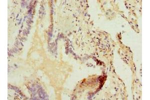 Immunohistochemistry of paraffin-embedded human lung tissue using ABIN7162554 at dilution of 1:100 (ZDHHC5 antibody  (AA 231-500))