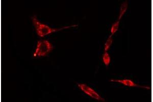 ABIN6274749 staining Hela cells by IF/ICC. (RPS15 antibody  (C-Term))
