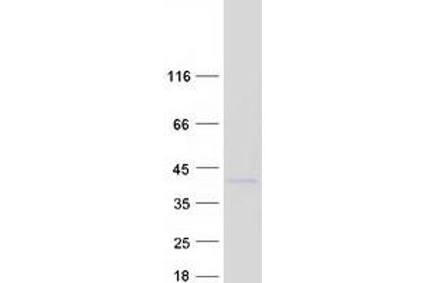 PPP1CB Protein (Transcript Variant 3) (Myc-DYKDDDDK Tag)