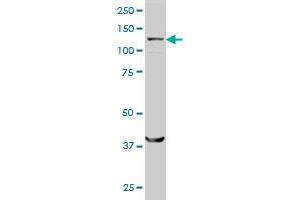 SMC6L1 monoclonal antibody (M01), clone 2E6 Western Blot analysis of SMC6L1 expression in HeLa . (SMC6 antibody  (AA 1-110))