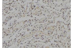 ABIN6278345 at 1/100 staining Human lung tissue by IHC-P. (RECQL2 antibody  (Internal Region))