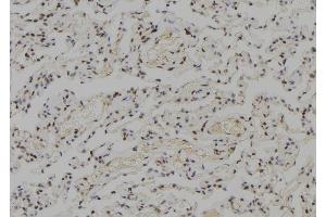 ABIN6278345 at 1/100 staining Human lung tissue by IHC-P.